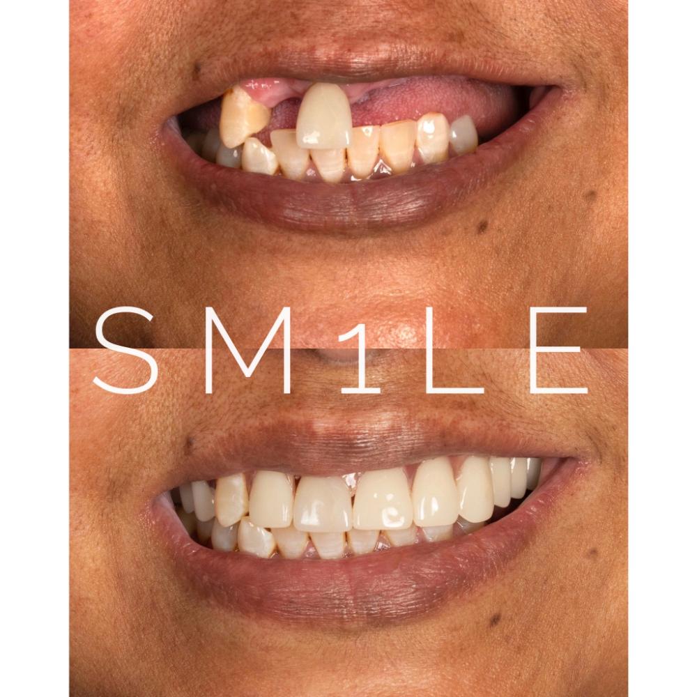 1Smile Dental | Implant Dentistry, TMJ Disorders and Pediatric Dentistry