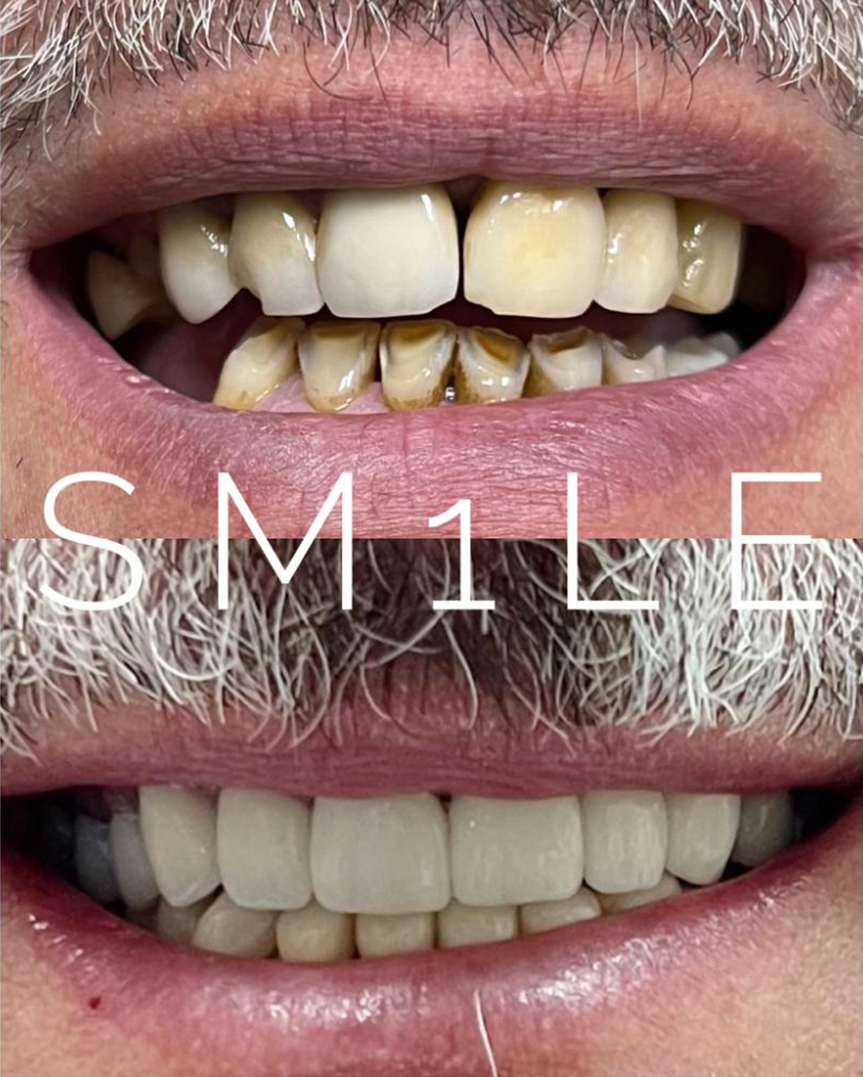 1Smile Dental | Pediatric Dentistry, Juvederm   and Extractions