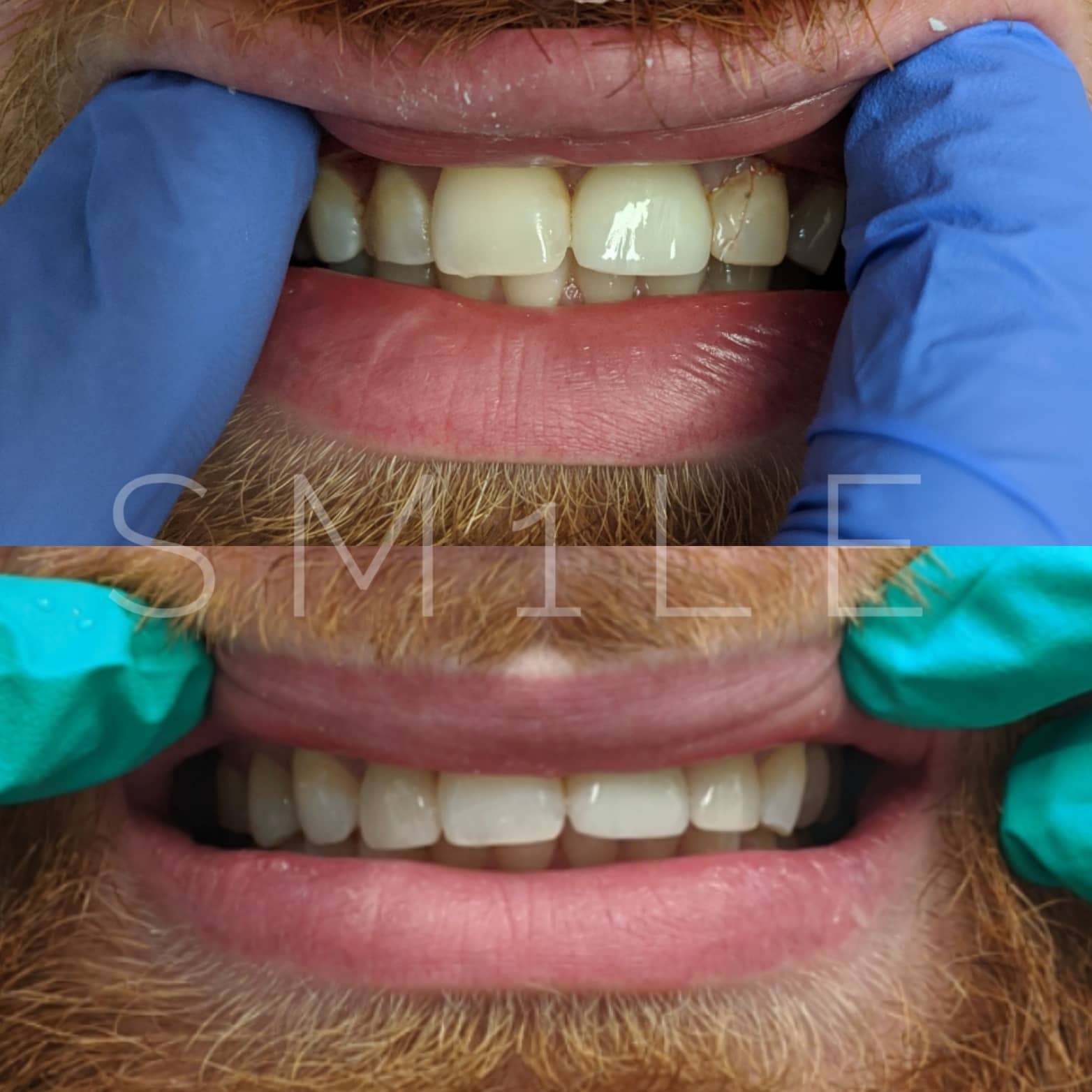 1Smile Dental | Digital Radiography, TMJ Disorders and Sedation Dentistry