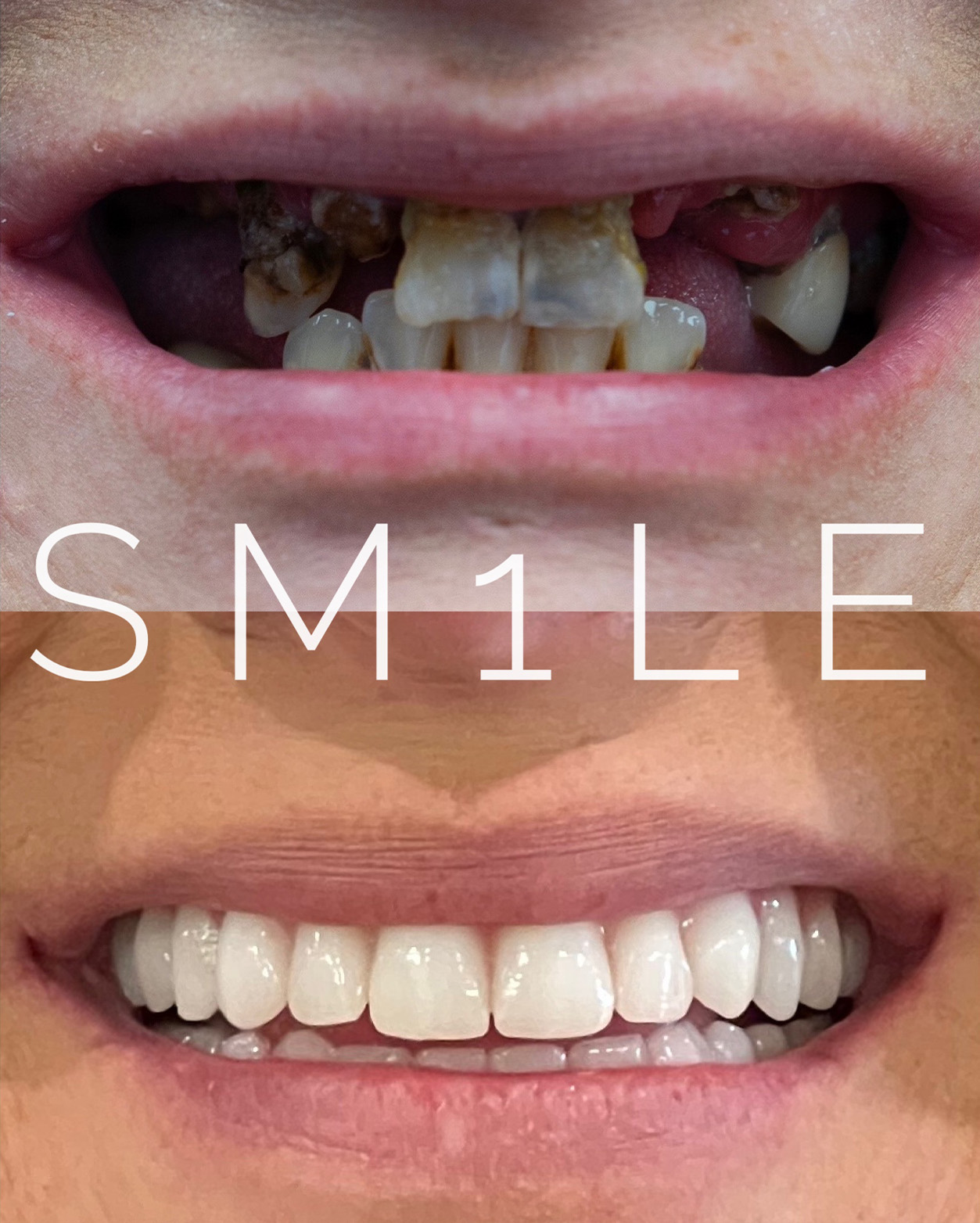 1Smile Dental | Pediatric Dentistry, Botox® and All-on-4®