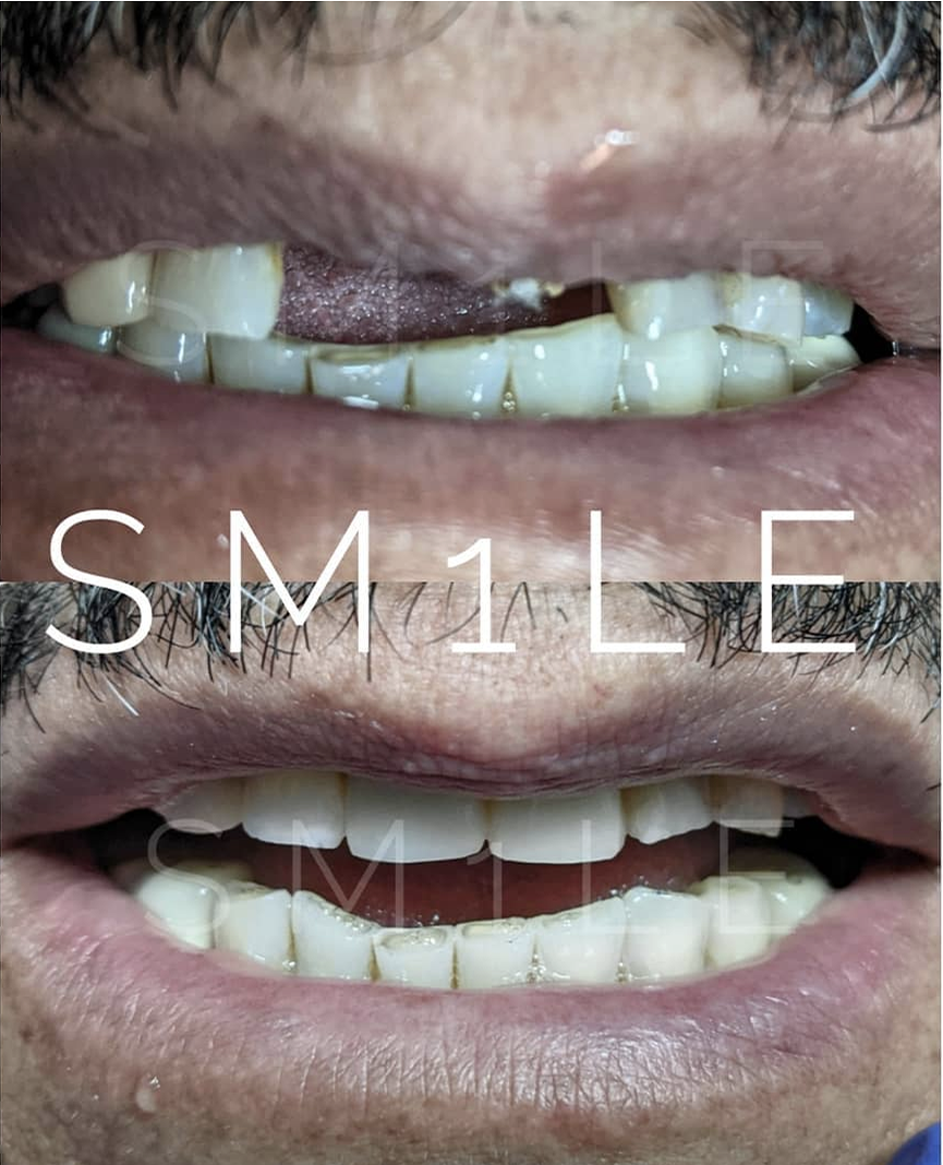 1Smile Dental | Braces, Botox® and Periodontal Treatment