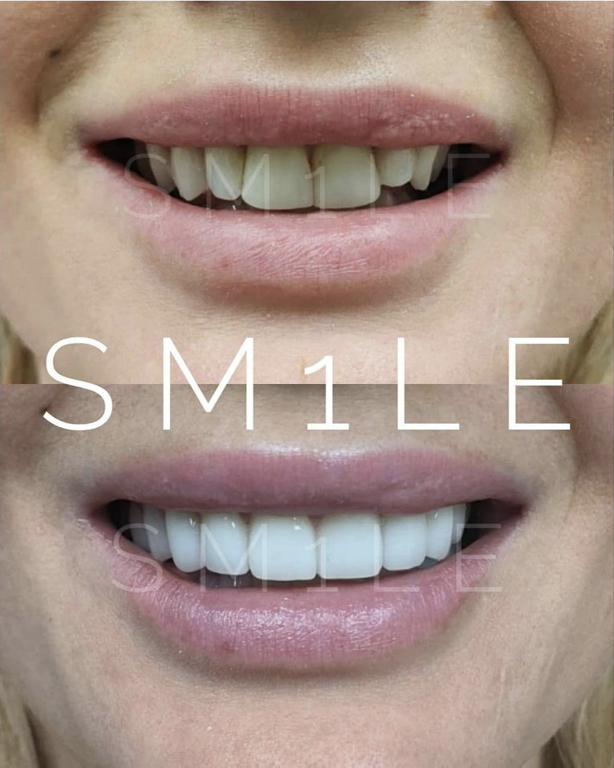 1Smile Dental | Emergency Treatment, Digital Radiography and Night Guards