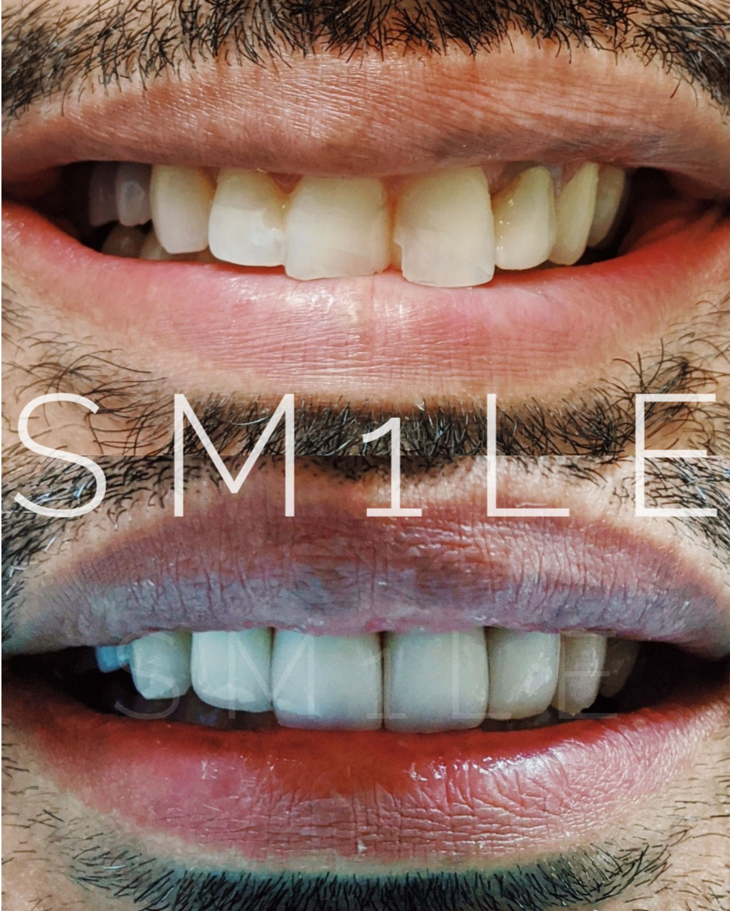 1Smile Dental | Sedation Dentistry, Teeth Whitening and Digital Radiography