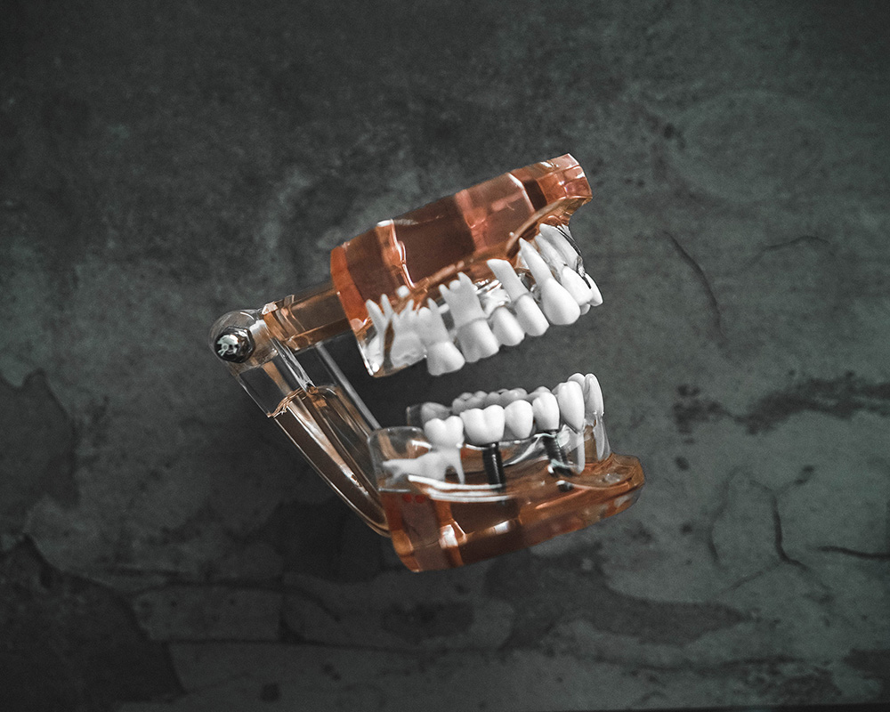 1Smile Dental | Pediatric Dentistry, Dentures and Ceramic Crowns