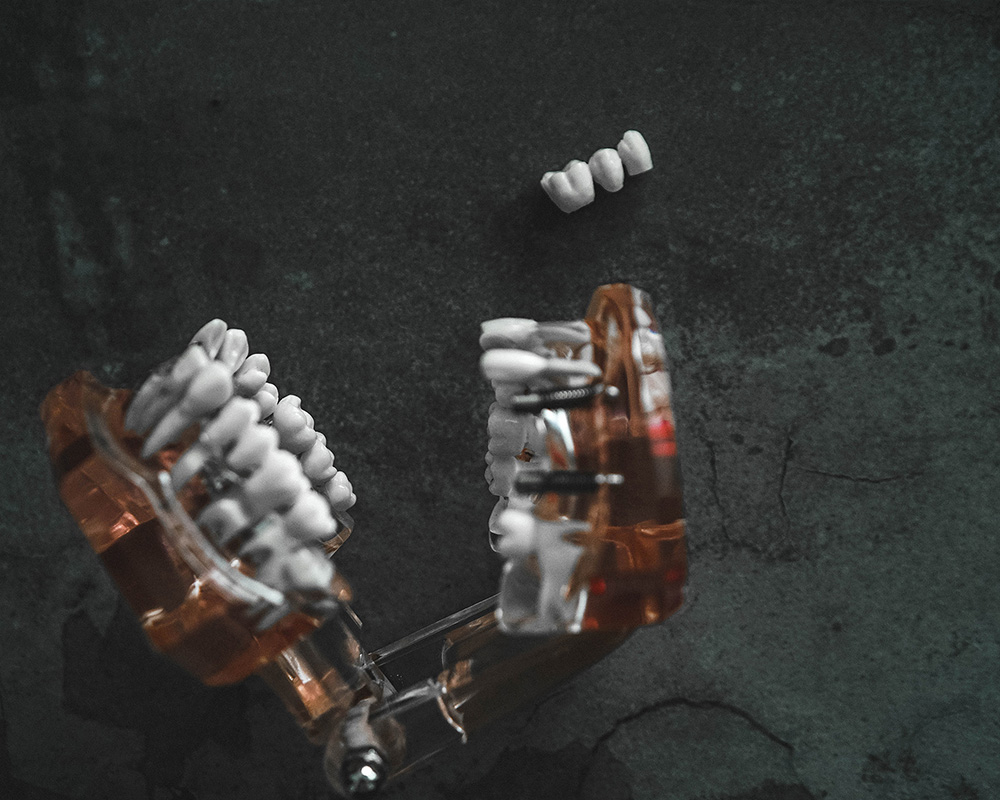 1Smile Dental | Ceramic Crowns, Snoring Appliances and Sedation Dentistry