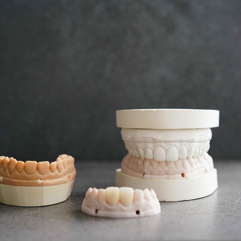 1Smile Dental | Sports Mouthguards, Pediatric Dentistry and Root Canals