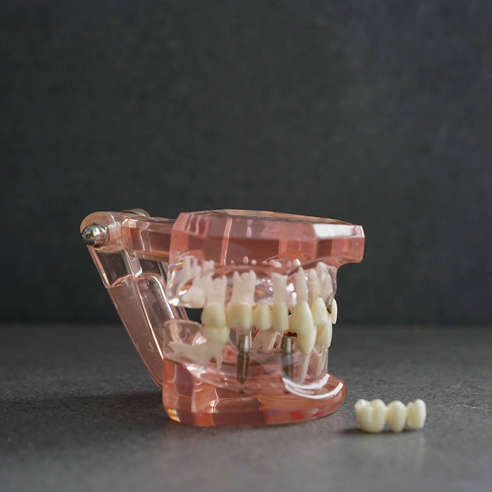 1Smile Dental | Botox®, Night Guards and All-on-4®