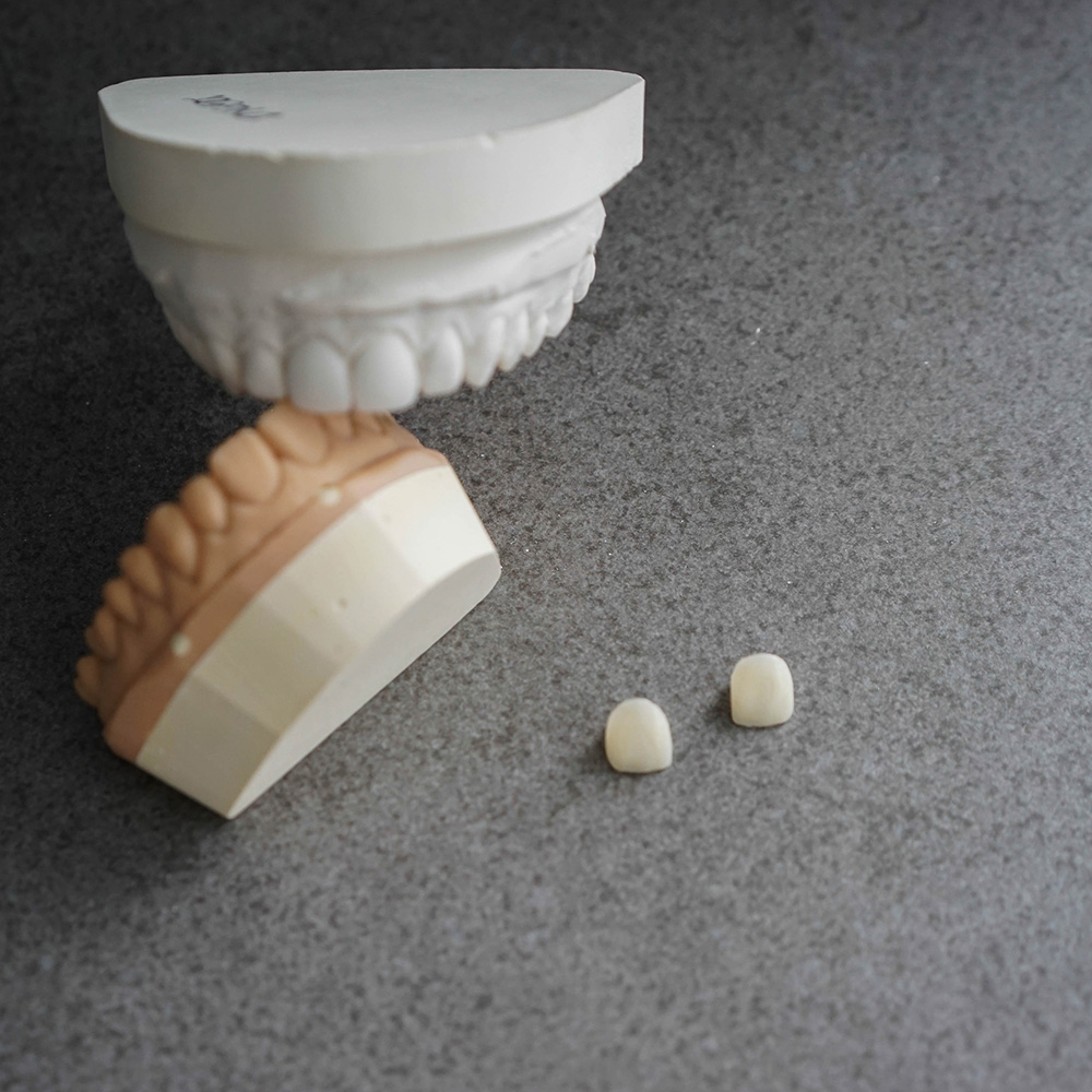 1Smile Dental | VELscope® Cancer Screening, Braces and Digital Radiography