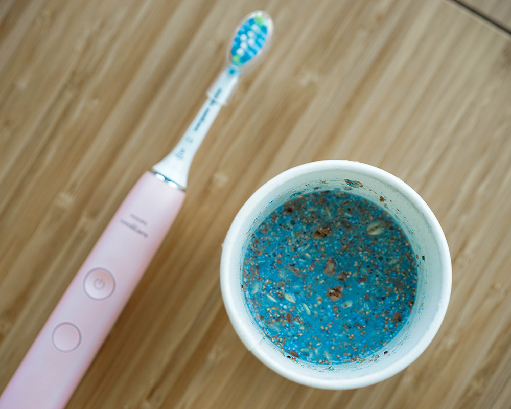 1Smile Dental | Teeth Whitening, Botox® and VELscope® Cancer Screening