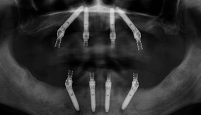 1Smile Dental | VELscope   Cancer Screening, Digital Radiography and Botox  