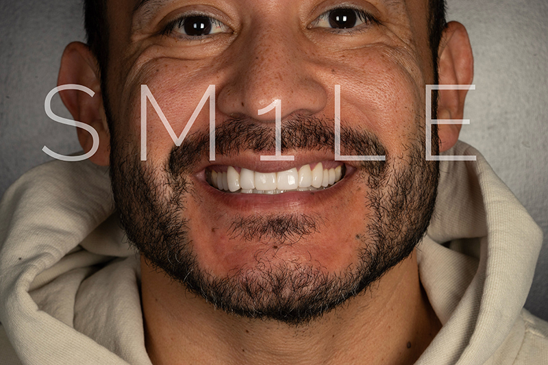1Smile Dental | Teeth Whitening, Digital Radiography and All-on-6 reg 